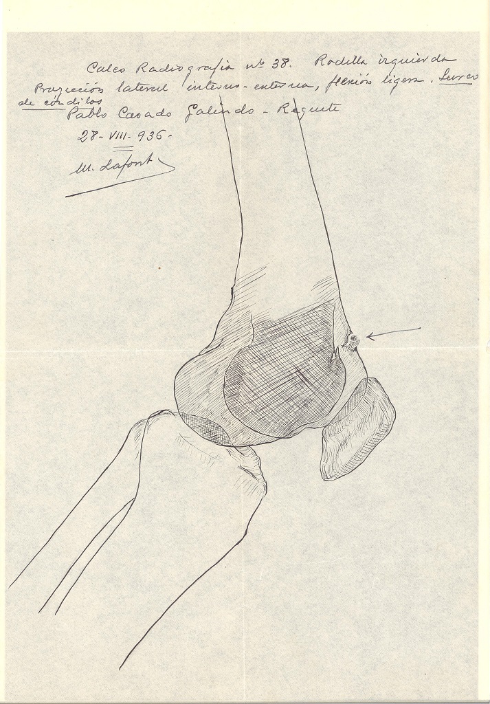 Calco radiografía rodilla izquierda